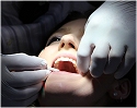 dentis